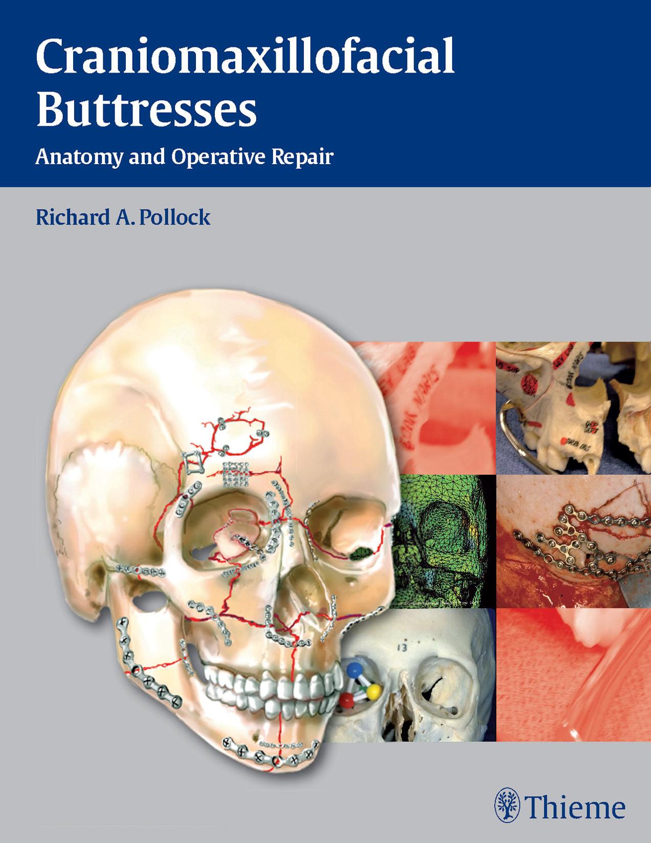 Craniomaxillofacial Buttresses: Anatomy and Operative Repair by Unknow