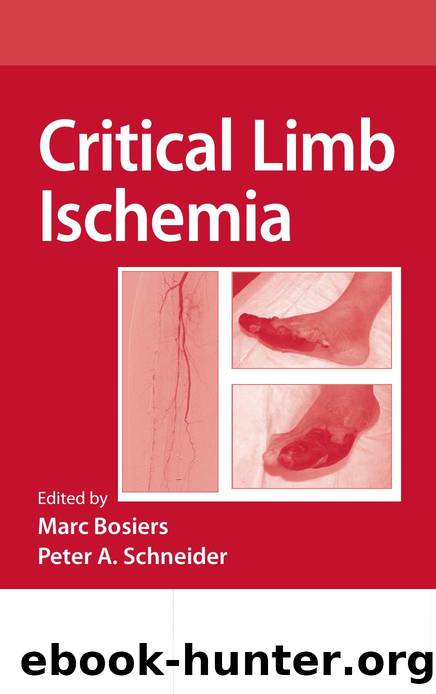 Critical limb ischemia by Unknown