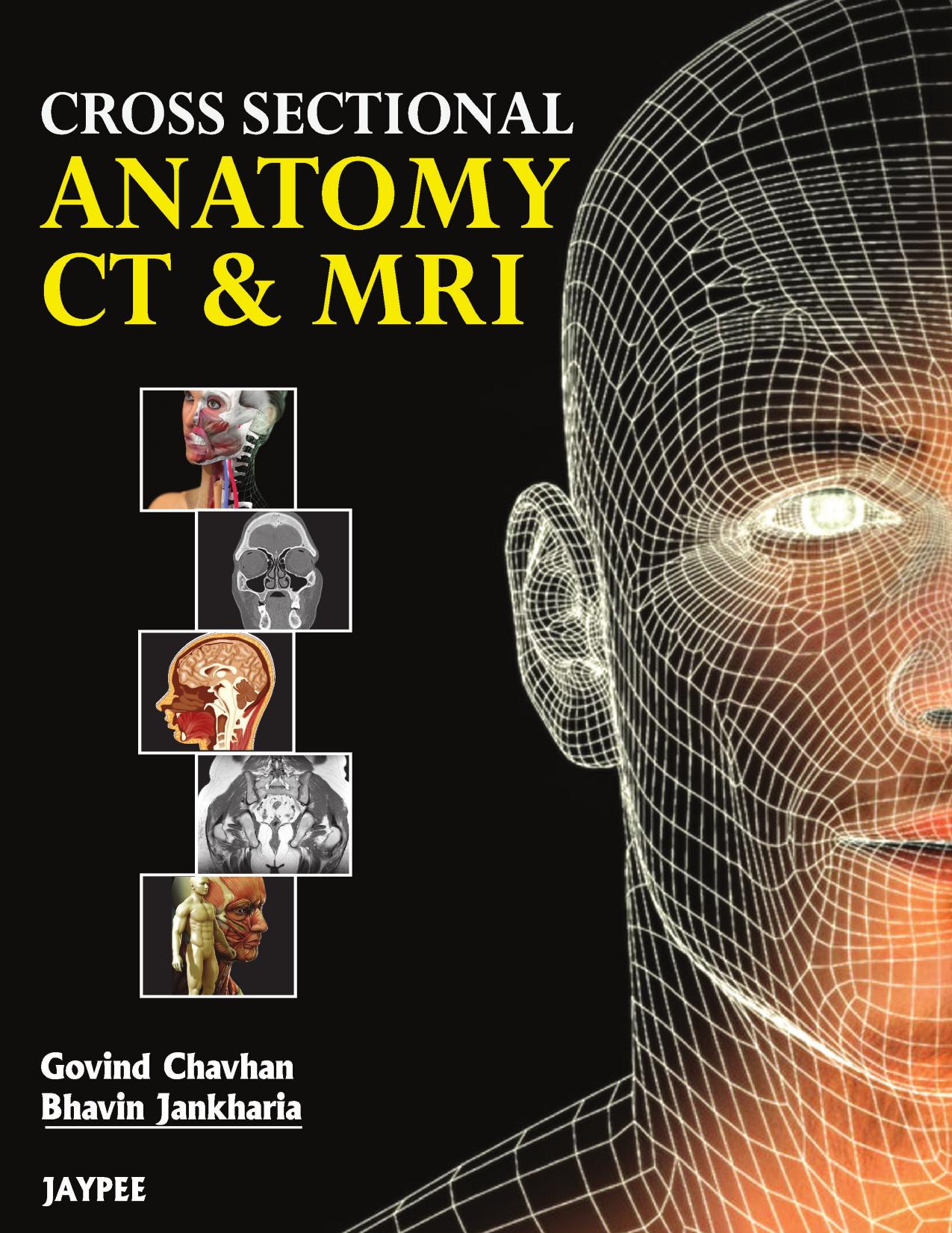 Cross Sectional Anatomy CT & MRI by Unknow