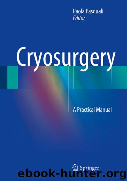 Cryosurgery by Paola Pasquali