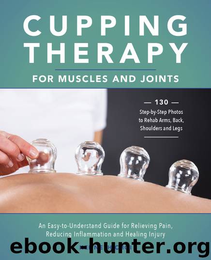 Cupping Therapy for Muscles and Joints by Kenneth Choi