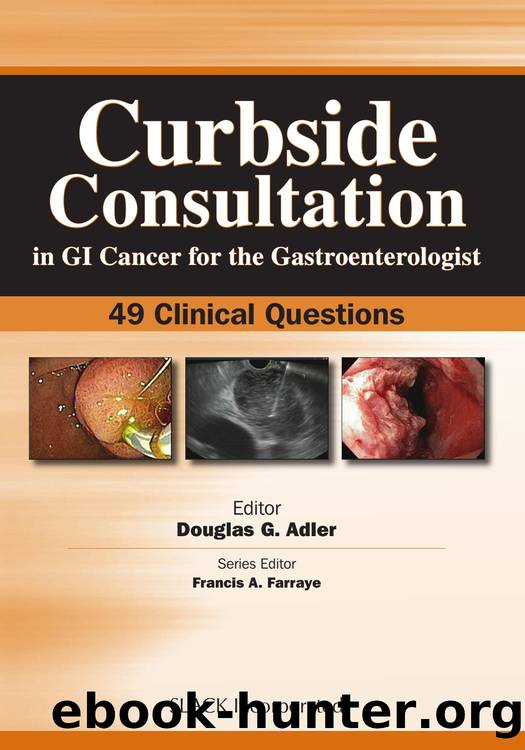 Curbside Consultation in GI Cancer for the Gastroenterologist : 49 Clinical Questions by Douglas Adler