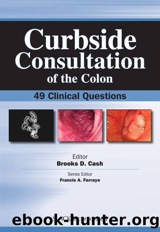 Curbside Consultation of the Colon : 49 Clinical Questions by Brooks Cash