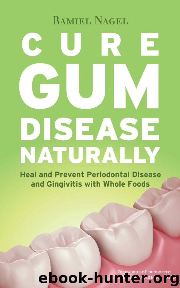 Cure Gum Disease Naturally: Heal and Prevent Periodontal Disease and Gingivitis with Whole Foods by Ramiel Nagel
