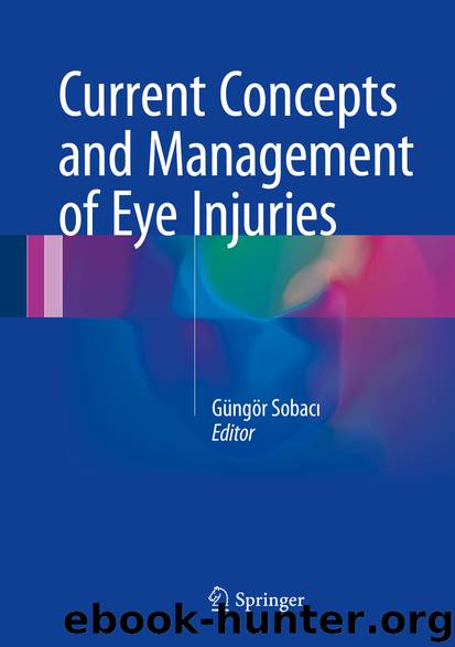 Current Concepts and Management of Eye Injuries by Güngör Sobacı