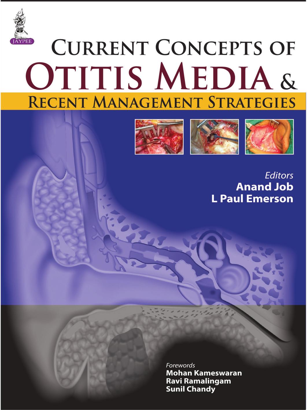 Current Concepts of Otitis Media and Recent Management Strategies by Anand Job; L. Paul Emerson