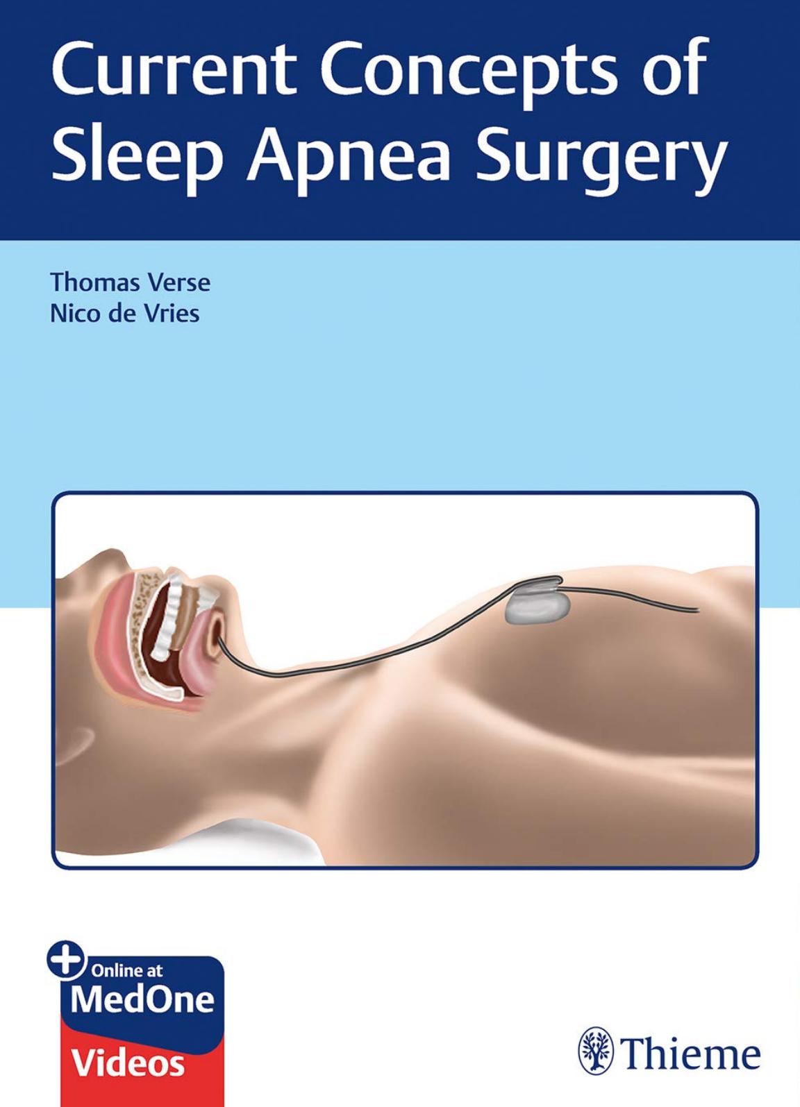 Current Concepts of Sleep Apnea Surgery by Thomas Verse Nico de Vries