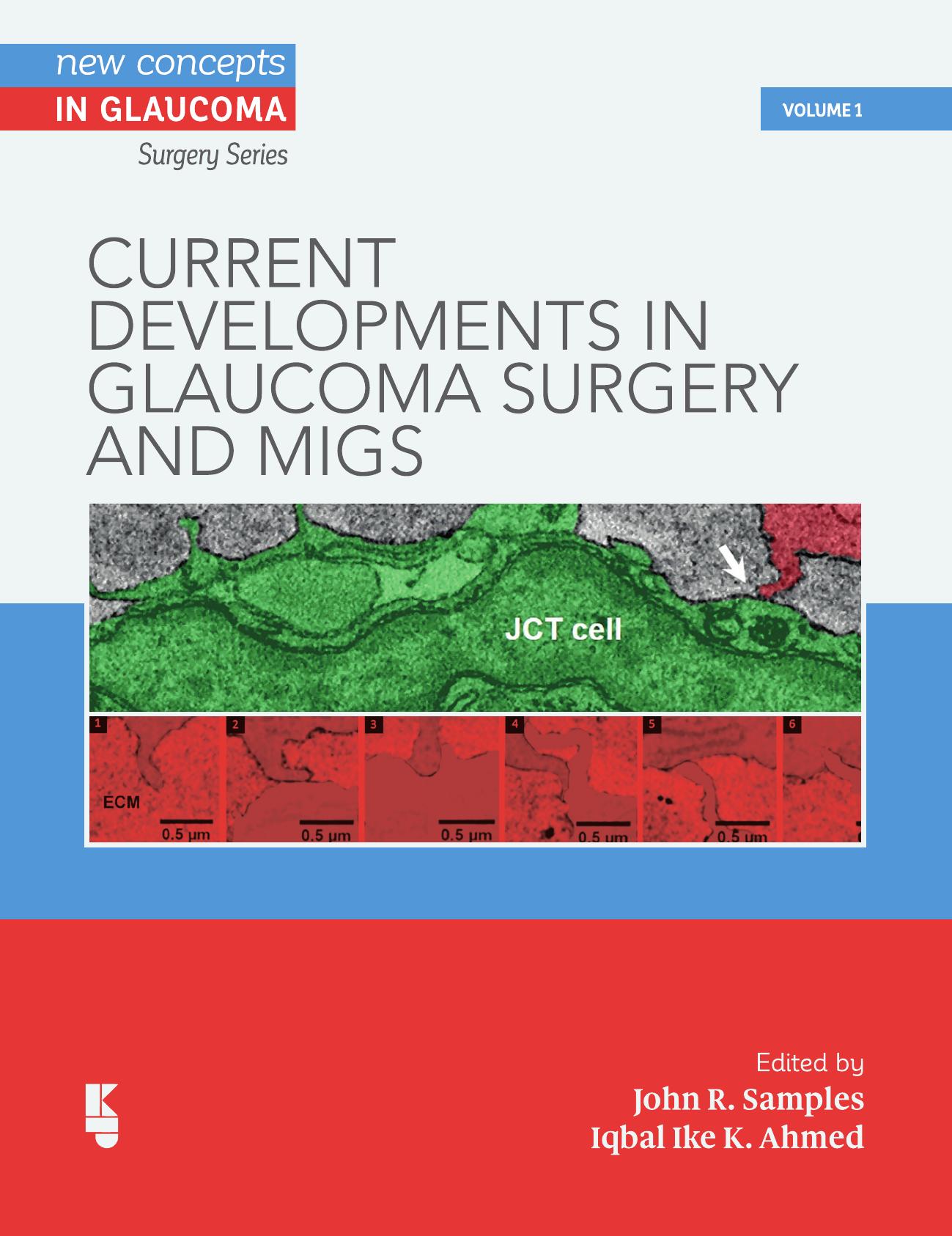 Current Developments in Glaucoma Surgery and MIGS by John R. Samples Iqbal (editor) Ike K. Ahmed (editor)