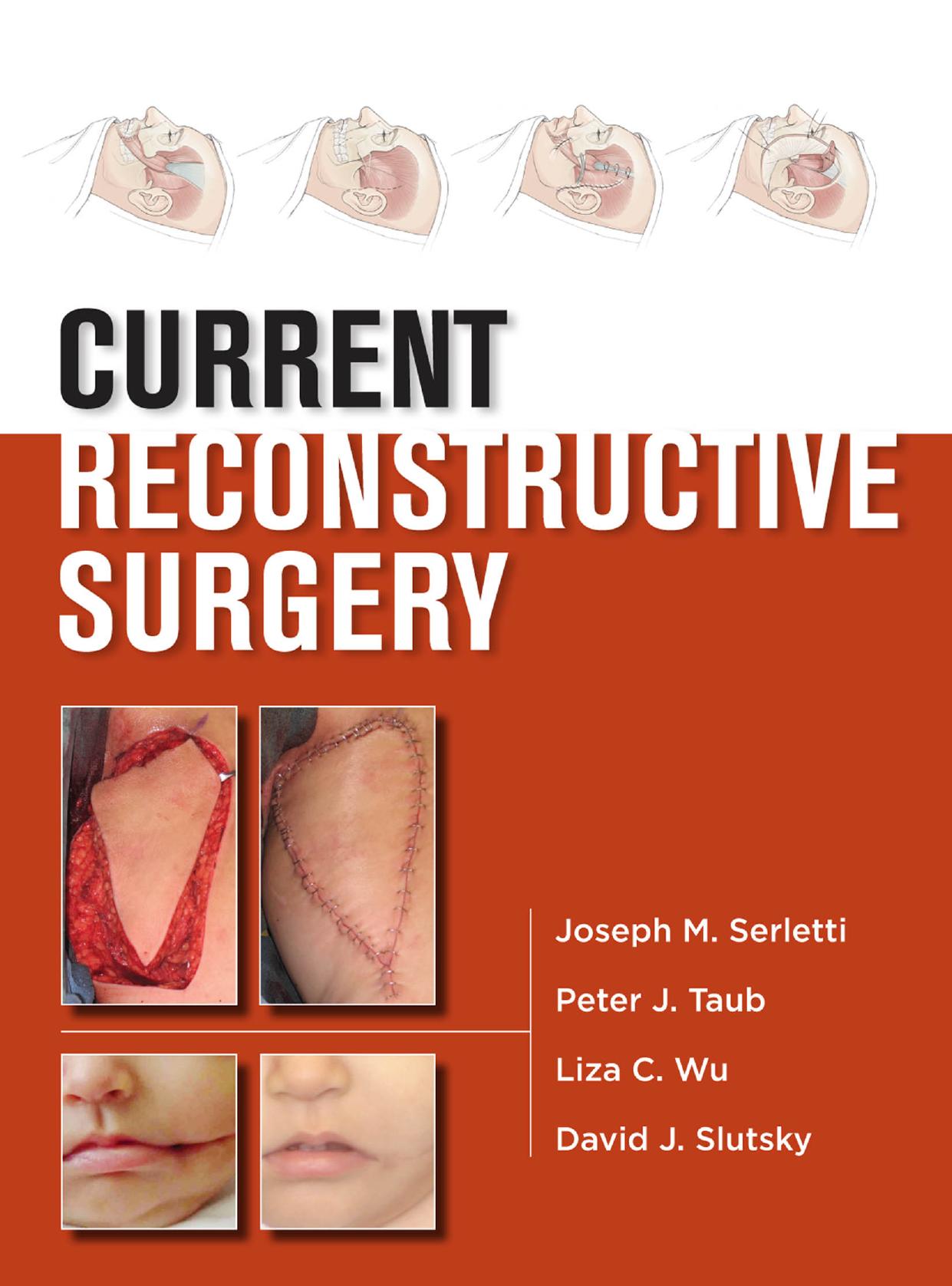 Current Reconstructive Surgery by Joseph M. Serletti Peter J. Taub Liza C. Wu David J. Slutsky