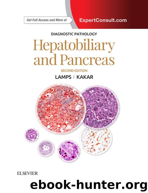 DIAGNOSTIC PATHOLOGY: Hepatobiliary and Pancreas by Lamps Laura W. & Kakar Sanjay