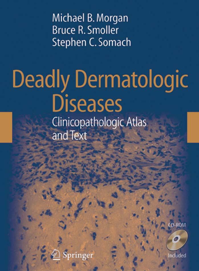 Deadly Dermatologic Diseases: Clinicopathologic Atlas and Text by Michael Morgan Bruce R. Smoller Stephen C. Somach