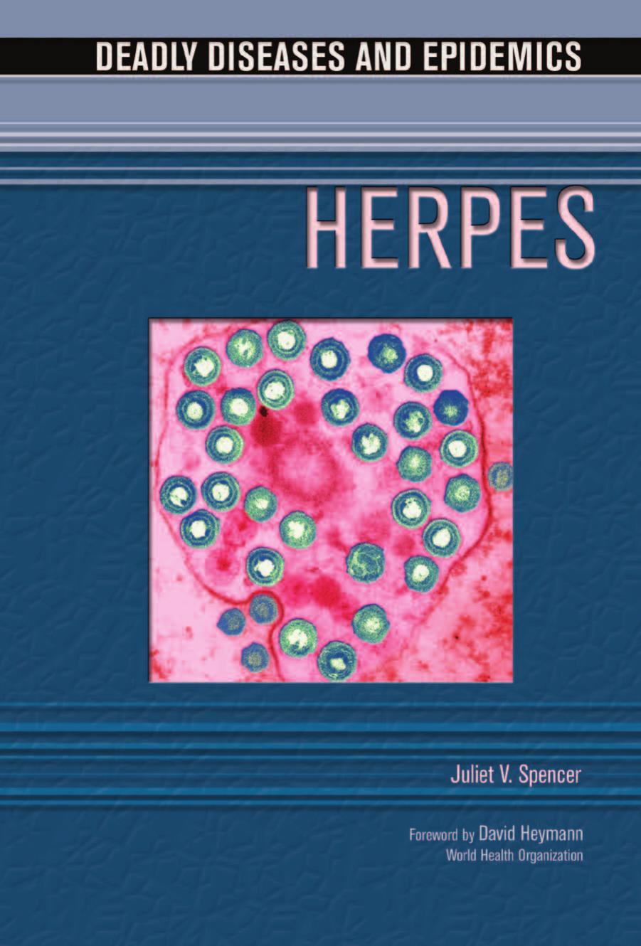 Deadly Diseases and Epidemics by Herpes (121p)