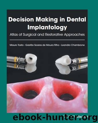 Decision Making in Dental Implantology by Mauro Tosta Gastão Soares de Moura Filho Leandro Chambrone