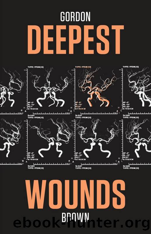 Deepest Wounds by Gordon