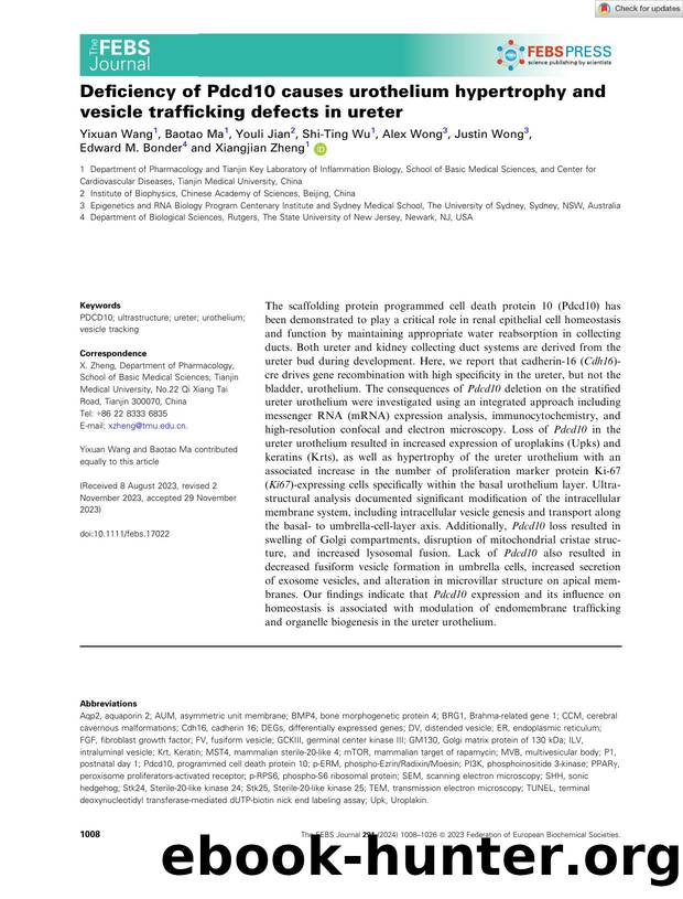 Deficiency of Pdcd10 causes urothelium hypertrophy and vesicle trafficking defects in ureter by Unknown