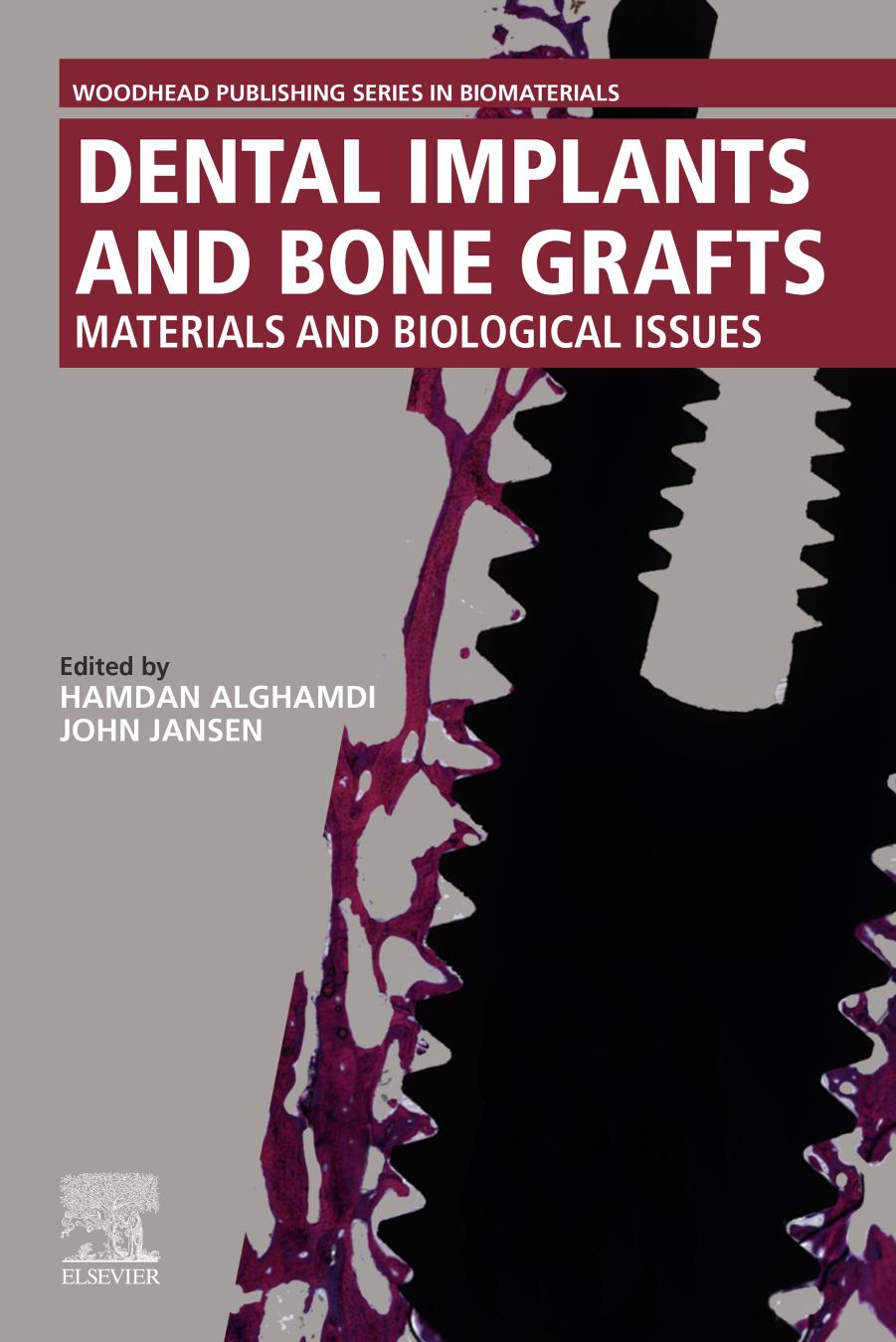 Dental implants and bone grafts : materials and biological issues by Alghamdi Hamdan; Jansen John