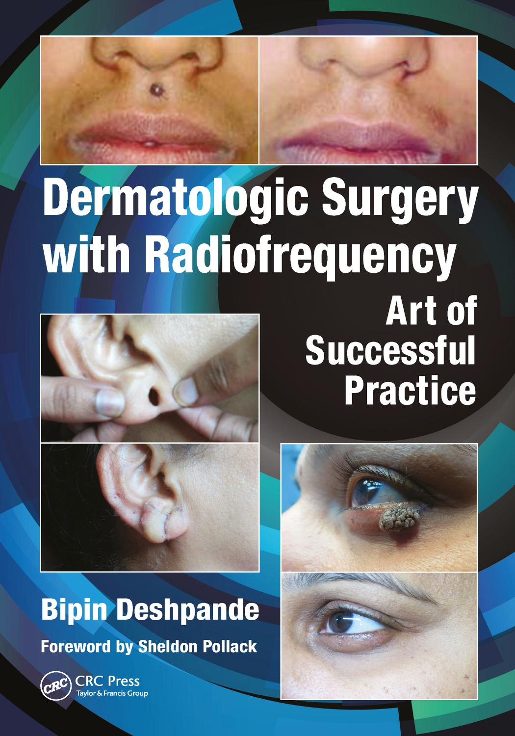 Dermatologic surgery with radiofrequency: art of successful practice by Deshpande Bipin
