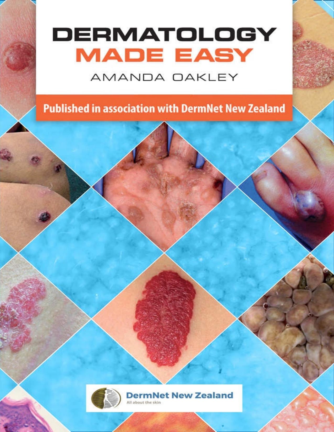 Dermatology Made Easy by Amanda Oakley