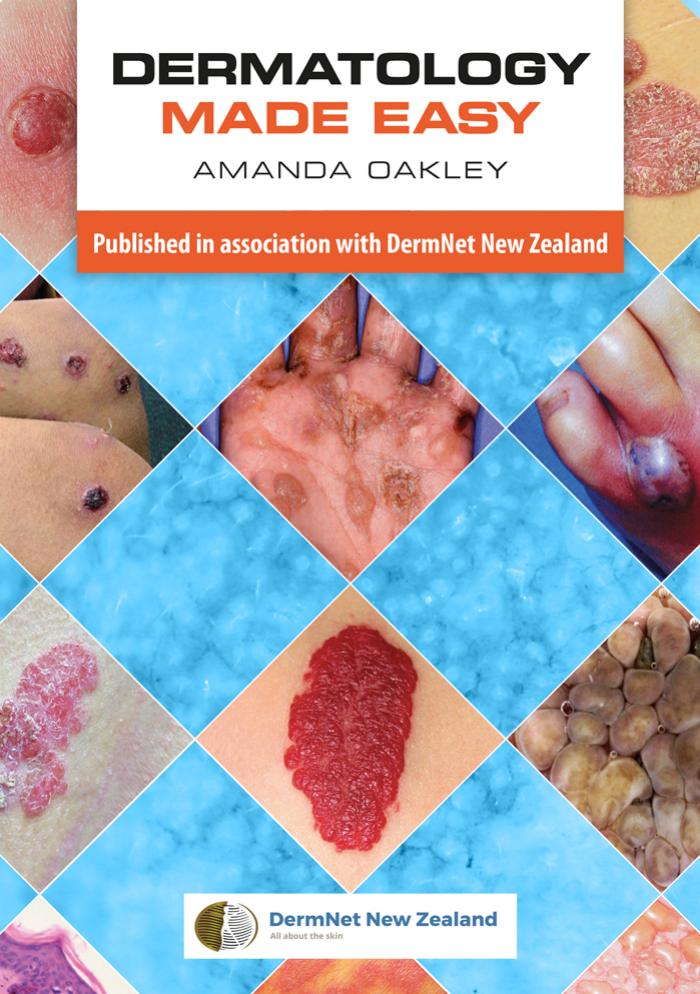 Dermatology Made Easy by Unknow