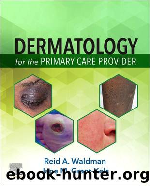 Dermatology for the Primary Care Provider E-Book by Waldman Reid A.; Grant-Kels Jane M.; & Jane M. Grant-Kels