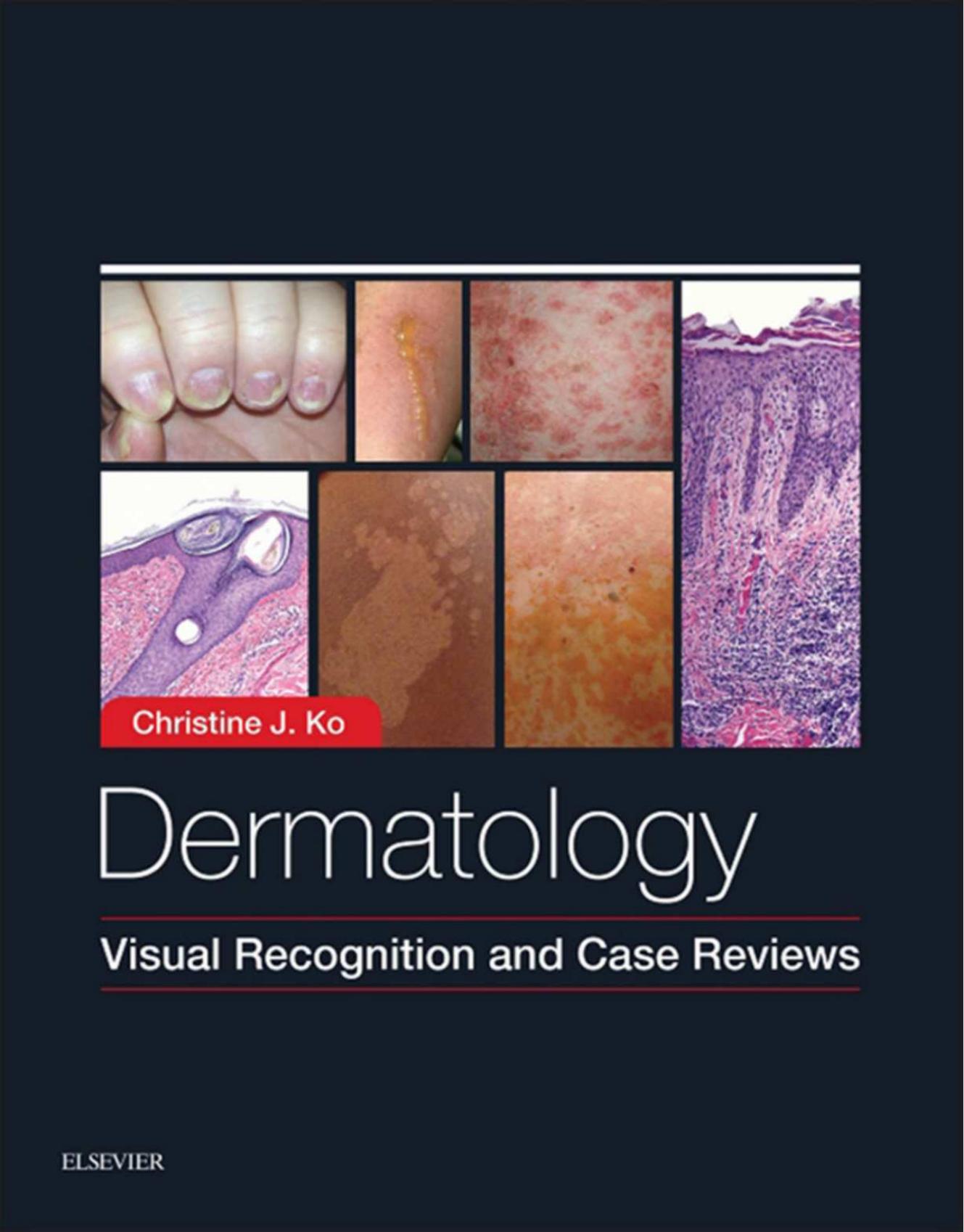 Dermatology: Visual Recognition and Case Reviews by Christine Ko