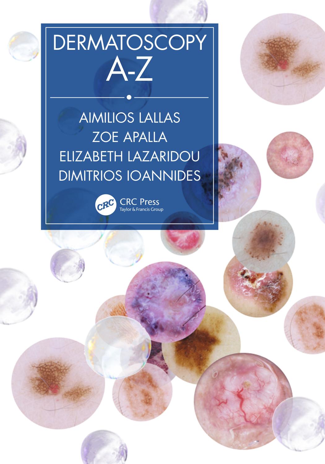 Dermatoscopy A-Z by Unknow