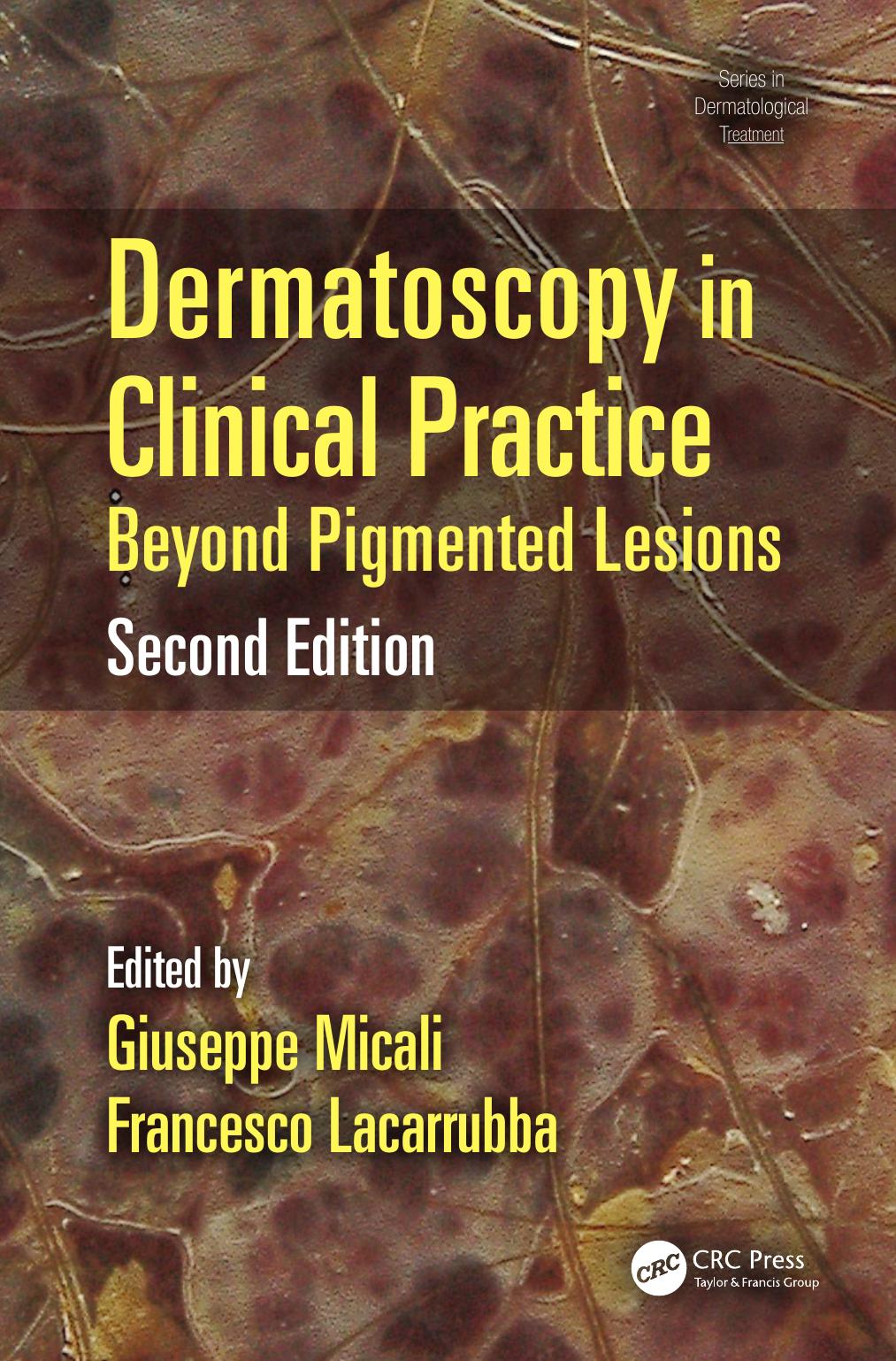 Dermatoscopy in Clinical Practice: Beyond Pigmented Lesions, Second Edition by Giuseppe Micali and Francesco Lacarrubba