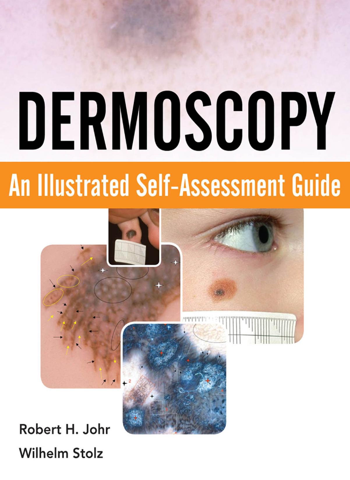 Dermoscopy: An Illustrated Self-Assessment Guide by Robert Johr Wilhelm Stolz