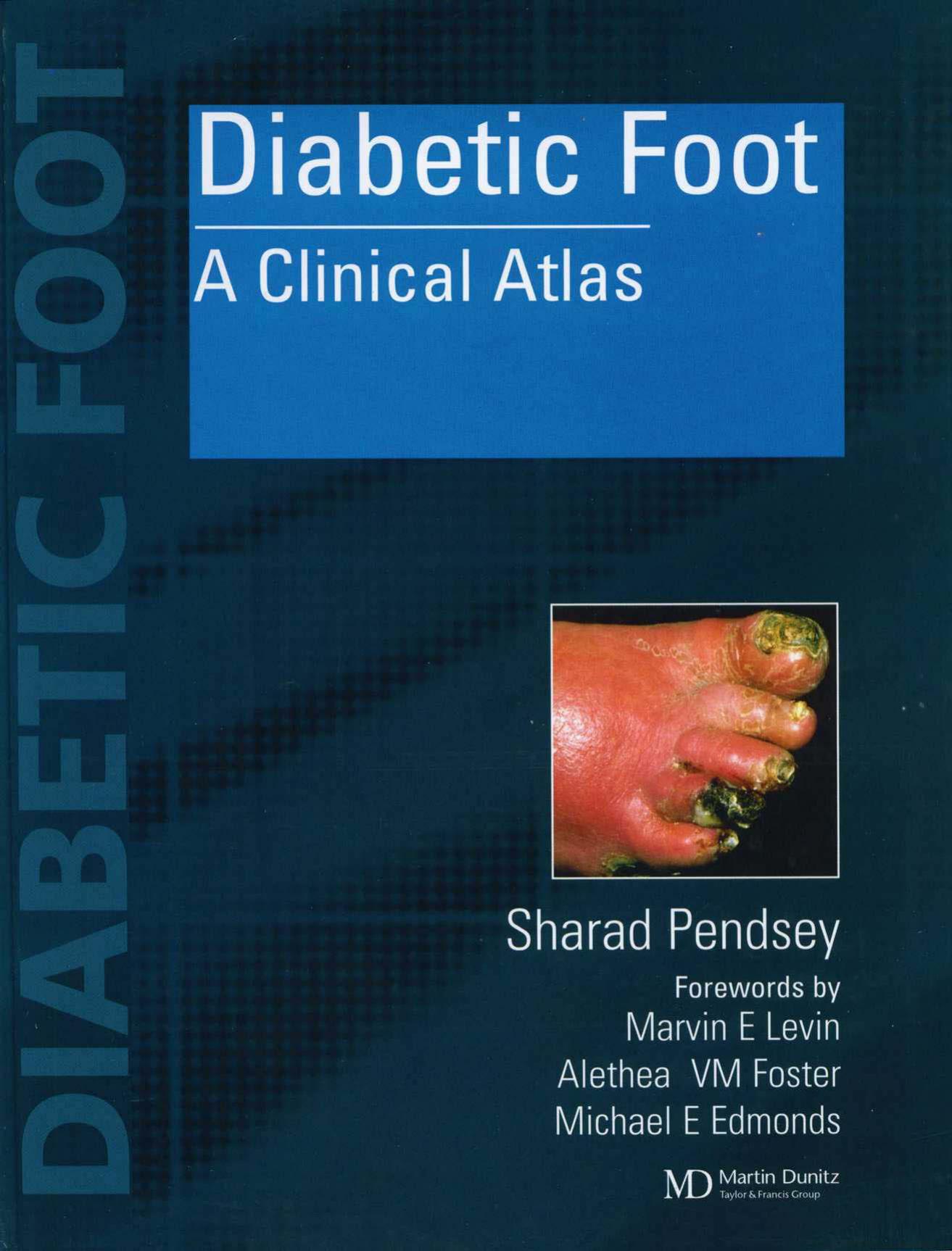 Diabetic Foot: A Clinical Atlas (Repost) by Unknow