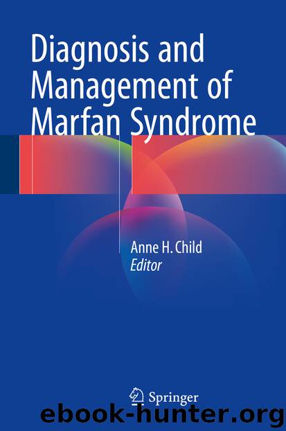 Diagnosis and Management of Marfan Syndrome by Anne H. Child