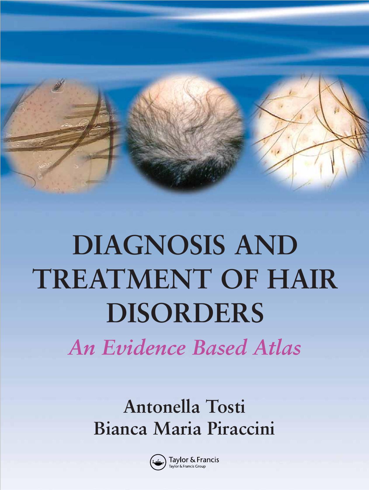Diagnosis and Treatment of Hair Disorders: An Evidence-Based Atlas by Antonella Tosti Bianca Maria Piraccini
