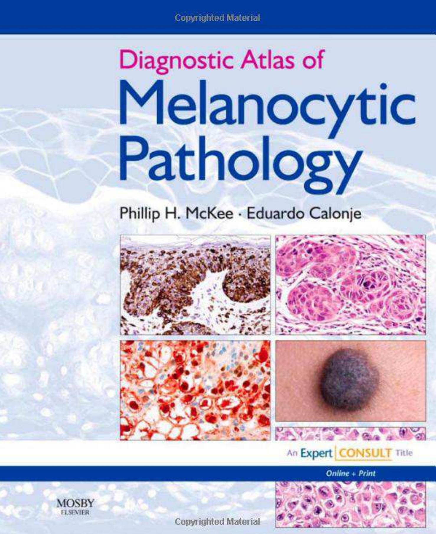 Diagnostic Atlas of Melanocytic Pathology by Phillip H. McKee J. Eduardo Calonje