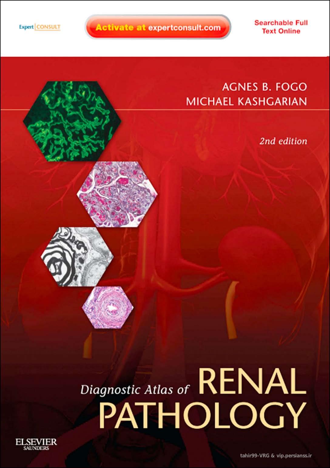 Diagnostic Atlas of Renal Pathology: A Companion to Brenner & Rectorâs The Kidney, 9th edition by Agnes B. Fogo MD