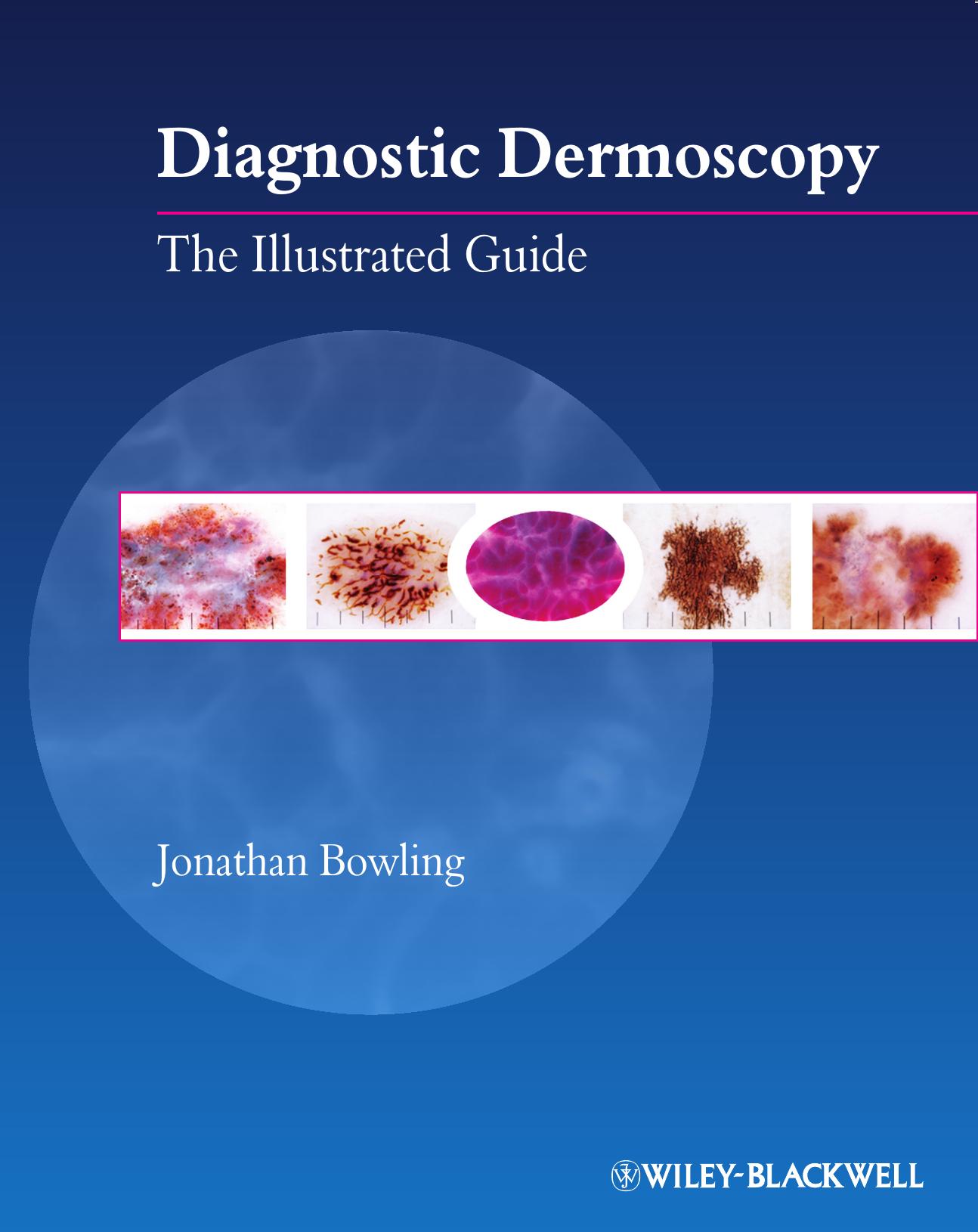 Diagnostic Dermoscopy: The Illustrated Guide by Jonathan Bowling