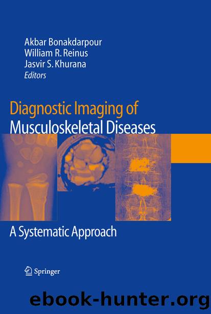 Diagnostic Imaging of Musculoskeletal Diseases by Akbar Bonakdarpour William R. Reinus & Jasvir S. Khurana
