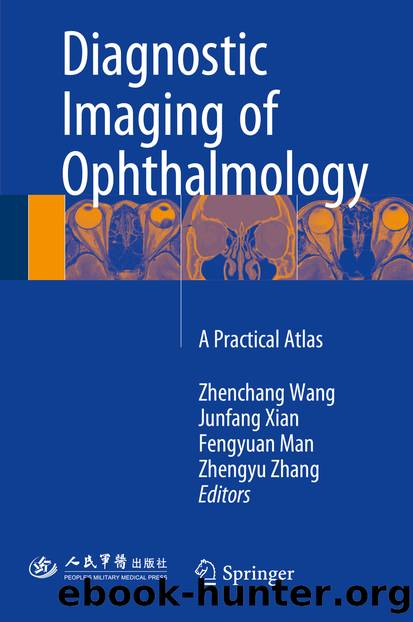 Diagnostic Imaging of Ophthalmology by Zhenchang Wang Junfang Xian Fengyuan Man & Zhengyu Zhang
