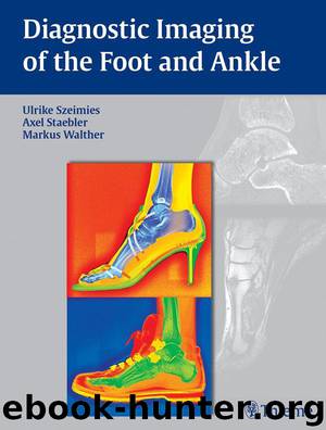 Diagnostic Imaging of the Foot and Ankle by Szeimies Ulrike & Stbler Axel & Walther Markus