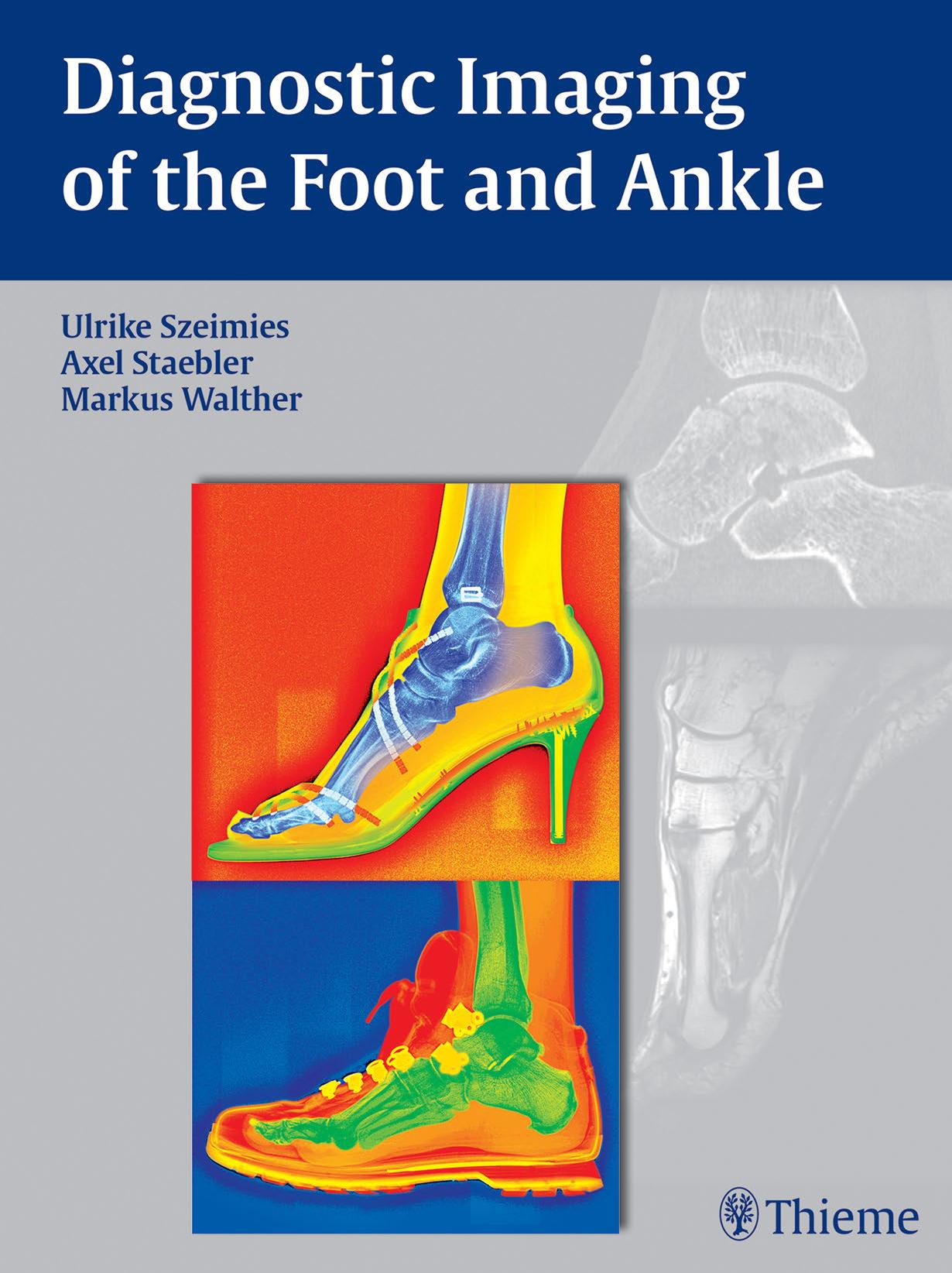 Diagnostic Imaging of the Foot and Ankle by Ulrike Szeimies & Axel Stbler & Markus Walther