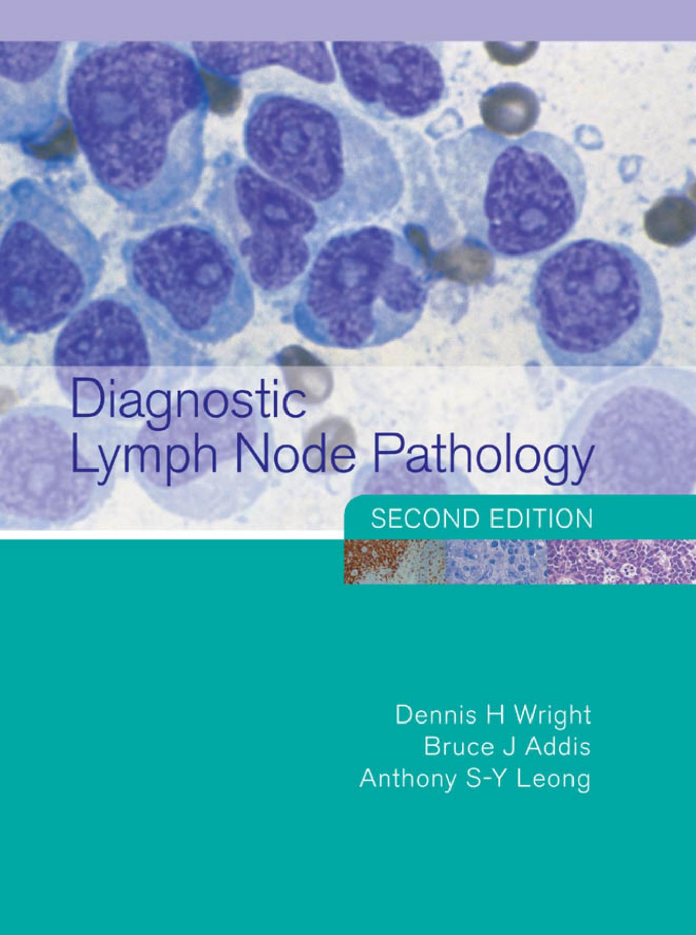 Diagnostic Lymph Node Pathology, 2nd Edition by Dennis Wright Bruce J Addis Anthony S-Y Leong