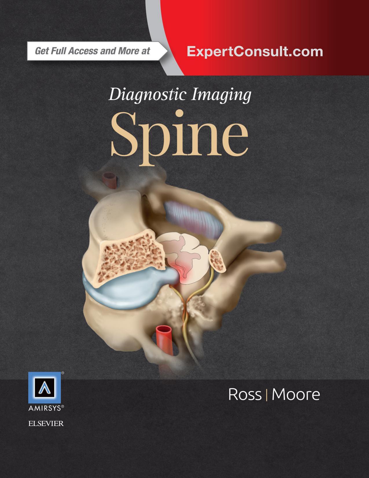 Diagnostic imaging Spine by Ross Moore