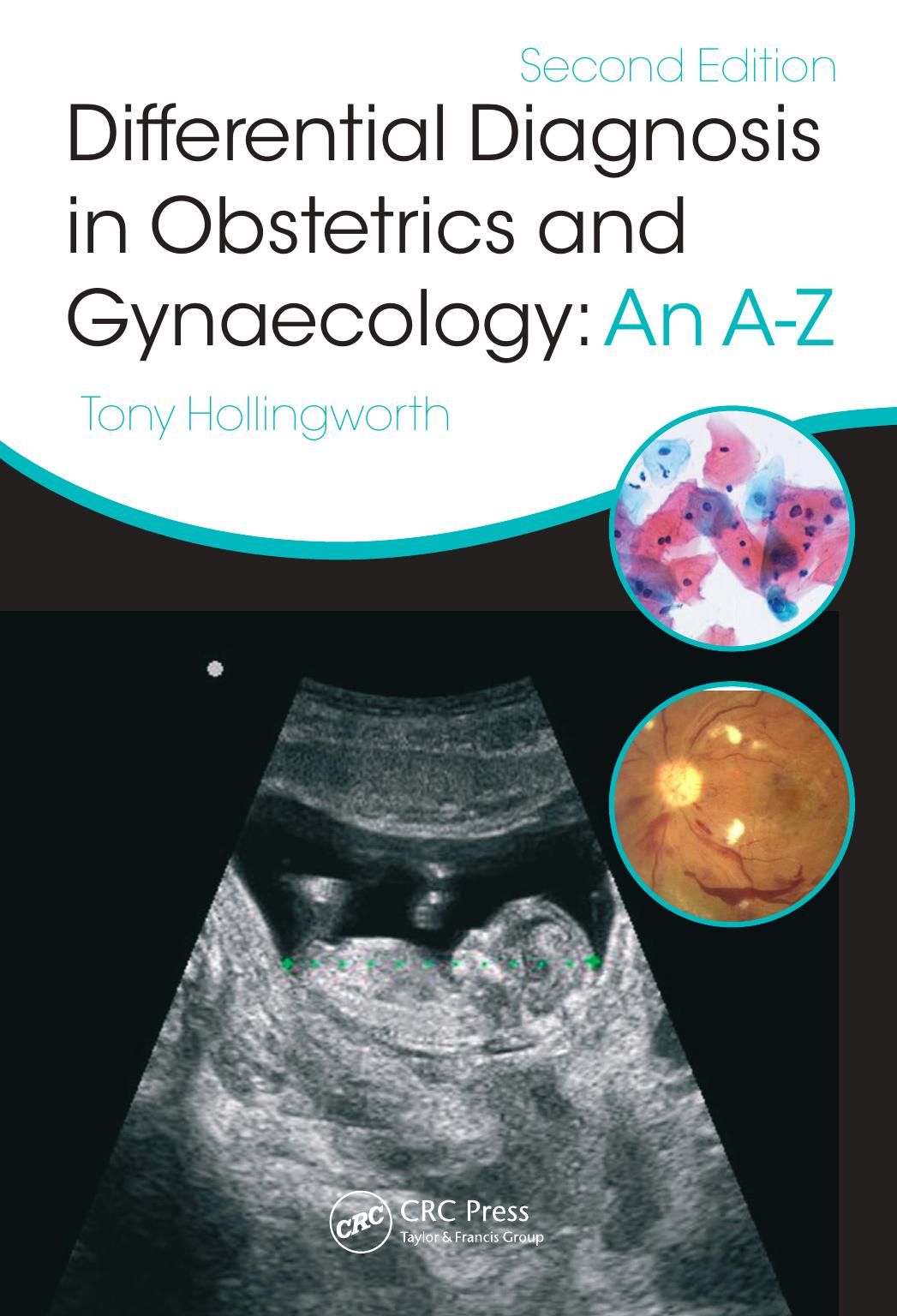 Differential Diagnosis in Obstetrics & Gynaecology An A-Z, Second Edition by Hollingworth Tony