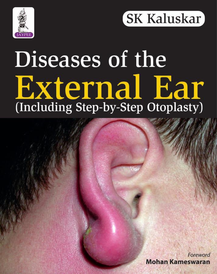 Diseases of the External Ear (Including Step-By-Step Otoplasty) by S. K. Kaluskar