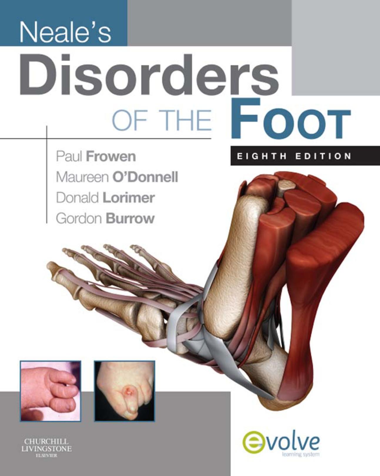 Disorders of the Foot by Paul Frowen Maureen O’Donnell Donald L Lorimer Gordon Burrow (ed.)