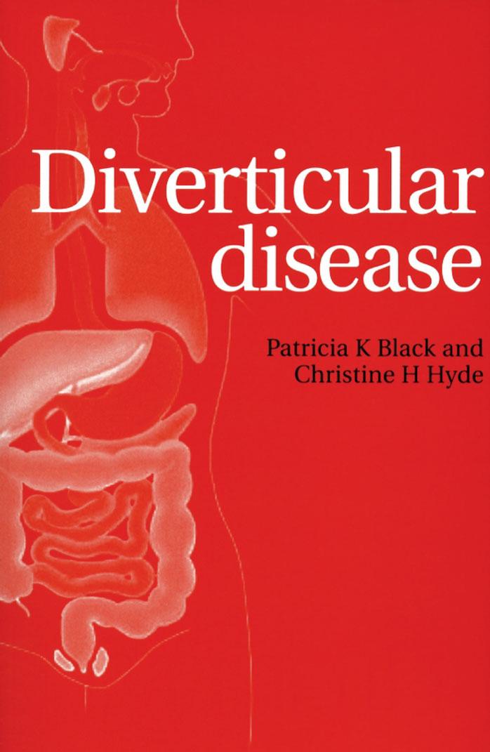 Diverticular disease by Patricia K Black; Christine H Hyde