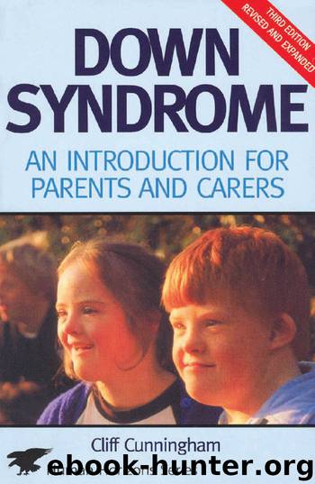Down Syndrome by Cliff Cunningham