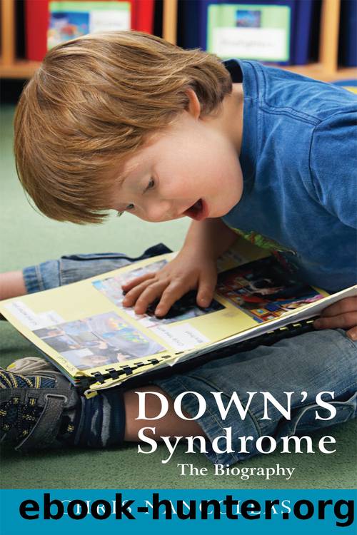 Down's Syndrome by Chris Nancollas