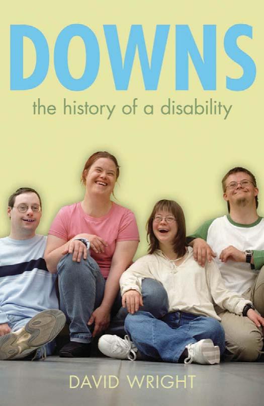 Down's Syndrome: The History of a Disability by Unknow
