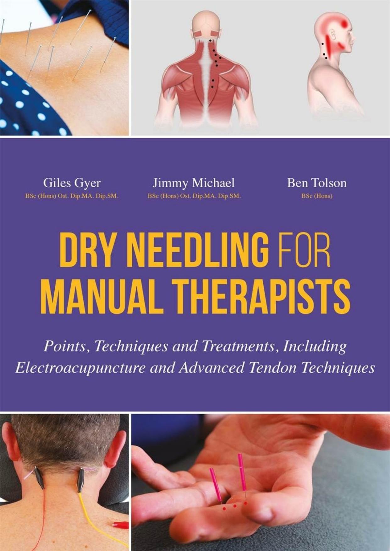 Dry Needling for Manual Therapists: Points, Techniques and Treatments, Including Electroacupuncture and Advanced Tendon Techniques by Giles Gyer & Jimmy Michael & Ben Tolson
