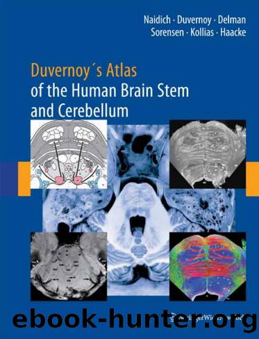 Duvernoy's Atlas of the Human Brain Stem and Cerebellum  High-Field MRI, Surface Anatomy, Internal Structure, Vascularization and 3 D Sectional Anatomy ( PDFDrive ) by Unknown