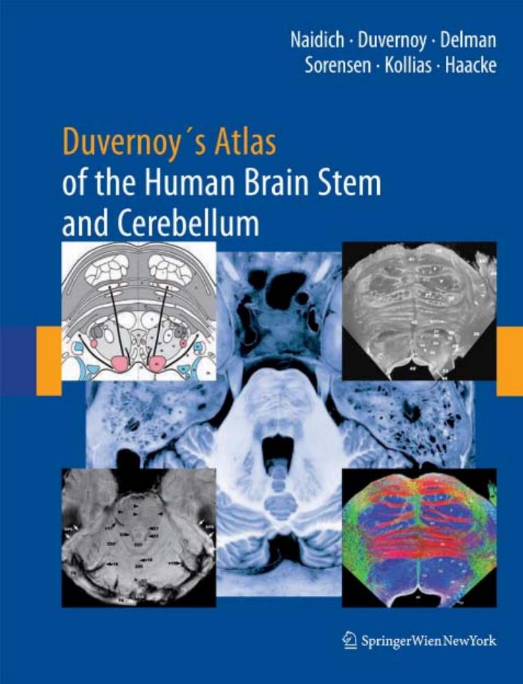 Duvernoy's Atlas of the Human Brain Stem and Cerebellum: High-Field MRI, Surface Anatomy, Internal Structure, Vascularization and 3 D Sectional Anatomy by unknow